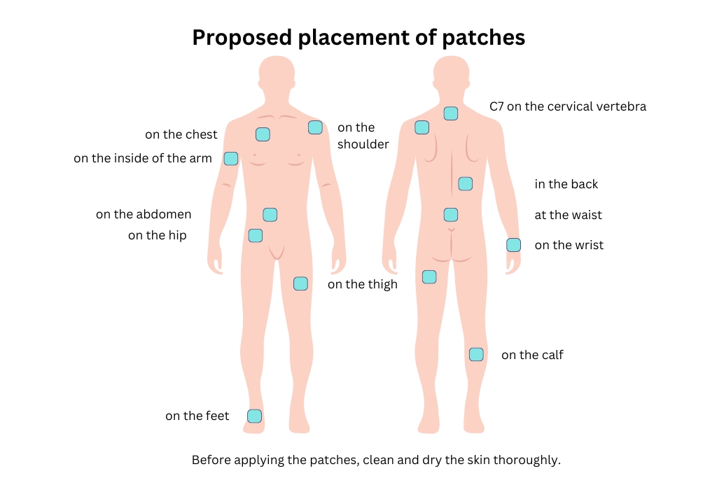 Proposed placement of patches